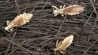 Түсінде биттеп кетсе